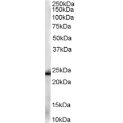 Glutathione S-Transferase P (GSTP1) Antibody