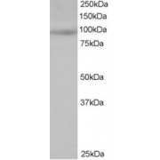abx430237 staining (0.5 µg/ml) of Jurkat lysate (RIPA buffer, 35 µg total protein per lane). Primary incubated for 1 hour. Detected by chemiluminescence.
