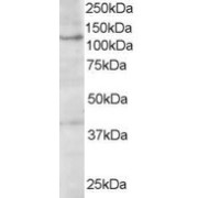 abx430238 (1 µg/ml) staining of A431 lysate (35 µg protein in RIPA buffer). Primary incubation was 1 hour. Detected by chemiluminescence.