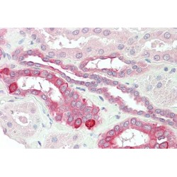 HVEM Antibody