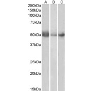 WB analysis using abx430243 (0.5 µg/ml) of Human Lymph Node (A), Spleen (B) and Placenta (C) lysates (35 µg protein in RIPA buffer). Detected by chemiluminescence.