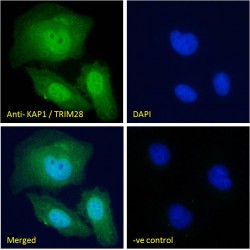 Transcription Intermediary Factor 1-Beta (TRIM28) Antibody