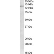 abx430246 Immunofluorescence analysis of paraformaldehyde fixed HeLa cells, permeabilized with 0.15% Triton. Primary incubation 1hr (10 µg/ml) followed by AF488 secondary antibody (2 µg/ml), showing nuclear staining. The nuclear stain is DAPI (blue). Negative control: Unimmunized goat IgG (10 µg/ml) followed by AF488 secondary antibody (2 µg/ml).