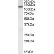 abx430247 (0.1 µg/ml) staining of Human Heart lysate (35 µg protein in RIPA buffer). Primary incubation was 1 hour. Detected by chemiluminescence.