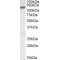 Potassium Chloride Cotransporters 3 (KCC3) Antibody