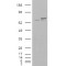 X-Ray Repair Cross-Complementing Protein 6 (XRCC6) Antibody