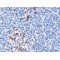 Interferon Induced Helicase C Domain Containing Protein 1 (IFIH1) Antibody