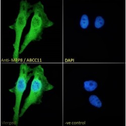 Migration Inhibitory Factor-Related Protein 8 (MRP8) Antibody
