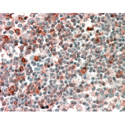 Neutrophil Cytosolic Factor 4 (NCF4) Antibody