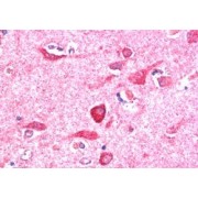 abx430271 (5 µg/ml staining of paraffin embedded Human Cerebral Cortex. Steamed antigen retrieval with citrate buffer pH 6, AP-staining.