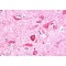 Pyk2 N-Terminal Domain-Interacting Receptor 1 (NIR1) Antibody