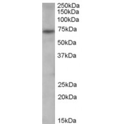 Protein-Arginine Deiminase Type-4 (PAD4) Antibody