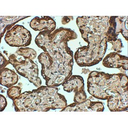 Plasminogen Activator Inhibitor 1 (PAI1) Antibody