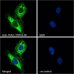 Phosphoenolpyruvate Carboxykinase, Mitochondrial (PCK2) Antibody