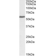 abx430290 (0.3 µg/ml) staining of cell line A431 lysate (35 µg protein in RIPA buffer). Primary incubation was 1 hour. Detected by chemiluminescence.