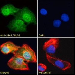 E3 ubiquitin-protein ligase TRIM21 (TRIM21) Antibody