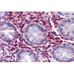 E3 ubiquitin-protein ligase TRIM21 (TRIM21) Antibody
