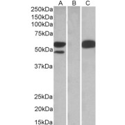 HEK293 lysate (10 µg protein in RIPA buffer) overexpressing Human TRIM21 with C-terminal MYC tag probed with abx430297 (1 µg/ml) in Lane A and probed with anti-MYC Tag (1/1000) in lane C. Mock-transfected HEK293 probed with abx430297 (1mg/ml) in Lane B. Detected by chemiluminescence.