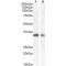 Hepatitis A Virus Cellular Receptor 2 (HAVCR2) Antibody