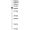 Putative Tyrosine-Protein Phosphatase TPTE (TPTE) Antibody