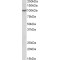 Ubiquitin Specific Peptidase 4 (USP4) Antibody