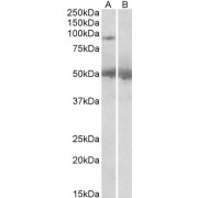 abx430310 (2 µg/ml) staining of Human Placenta lysate (35 µg protein in RIPA buffer) with (B) and without (A) blocking with the immunizing peptide. Primary incubation was 1 hour. Detected by chemiluminescence.
