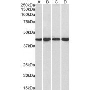 abx430318 (1 µg/ml) staining of HeLa (A), HepG2 (B), Jurkat (C) and NIH3T3 (D) nuclear lysate (35 µg protein in RIPA buffer). Detected by chemiluminescence.