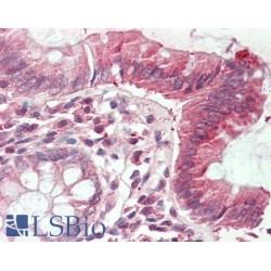 Chloride Intracellular Channel Protein 1 (CLIC1) Antibody