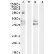 abx430326 (0.3 µg/ml) staining of Mouse Liver lysate (35 µg protein in RIPA buffer). Primary incubation was 1 hour. Detected by chemiluminescence.