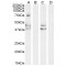Type-1 Angiotensin II Receptor (AGTR1) Antibody