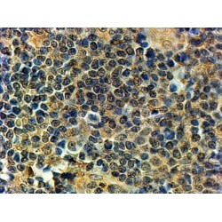 PR/SET Domain 1 (PRDM1) Antibody
