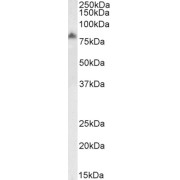 Biotinylated (1 µg/ml) staining of Human Frontal Cortex lysate (35 µg protein in RIPA buffer), exactly mirroring its parental non-biotinylated product. Primary incubation was 1 hour. Detected by chemiluminescence, using streptavidin-HRP and using NAP blocker as a substitute for skimmed milk.