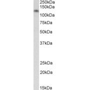 abx430333 (0.03 µg/ml) staining of Human Heart lysate (35 µg protein in RIPA buffer). Primary incubation was 1 hour. Detected by chemiluminescence.