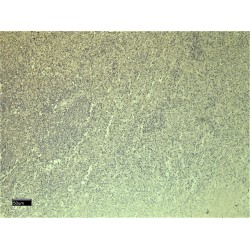 Chemokine C-X-C-Motif Receptor 3 (CXCR3) Antibody
