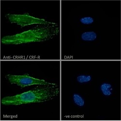 Corticotropin Releasing Hormone Receptor 1 (CRHR1) Antibody