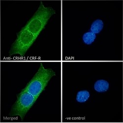 Corticotropin Releasing Hormone Receptor 1 (CRHR1) Antibody