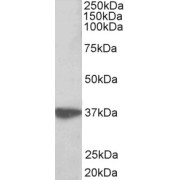abx430337 (0.3 µg/ml) staining of Jurkat lysate (35 µg protein in RIPA buffer). Primary incubation was 1 hour. Detected by chemiluminescence.