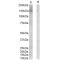 V-Erb B2 Erythroblastic Leukemia Viral Oncogene Homolog 3 (ERBB3) Antibody