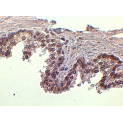 Forkhead Box Protein A1 (FOXA1) Antibody