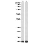 abx430356 (0.3 µg/ml) staining of HeLa (A) and HepG2 (B) lysates (35 µg protein in RIPA buffer). Primary incubation was 1 hour. Detected by chemiluminescence.