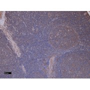 Immunohistochemistry analysis of paraffin-embedded Human Tonsil using Integrin Alpha M / CD11b (ITGAM) Antibody (8 µg/ml). Heat induced antigen retrieval with citrate buffer pH 6, HRP-staining.