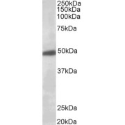 Western blot analysis of Human Brain (Substantia Nigra) lysate (35 µg protein in RIPA buffer) using G Protein-Activated Inward Rectifier Potassium Channel 2 (KCNJ6) Antibody (0.5 µg/ml).