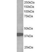 abx430371 staining (1 µg/ml) of Human Brain lysate (RIPA buffer, 35 µg total protein per lane). Primary incubated for 1 hour. Detected by chemiluminescence.