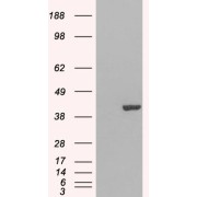 abx430374 (0.3 µg/ml) staining of Jurkat lysate (30 µg protein in RIPA buffer). Primary incubation was 1 hour. Detected by chemiluminescence.