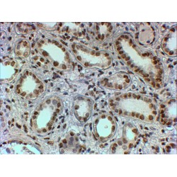 Polypyrimidine Tract-Binding Protein 1 (PTBP1) Antibody