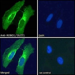 Roundabout Guidance Receptor 1 (ROBO1) Antibody