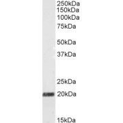 abx430383 (0.5 µg/ml) staining of Mouse Foetal Brain lysate (35 µg protein in RIPA buffer). Primary incubation was 1 hour. Detected by chemiluminescence.