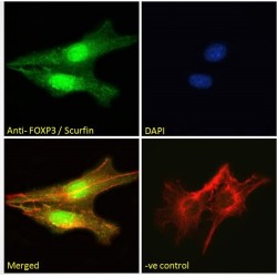 Forkhead Box Protein P3 (FOXP3) Antibody