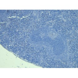 Forkhead Box Protein P3 (FOXP3) Antibody