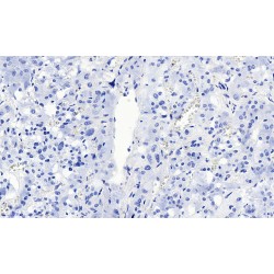Synaptic Vesicular Amine Transporter (SLC18A2) Antibody